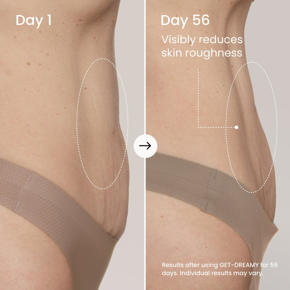 MAËLYS GET-DREAMY Overnight Toning Body Whip